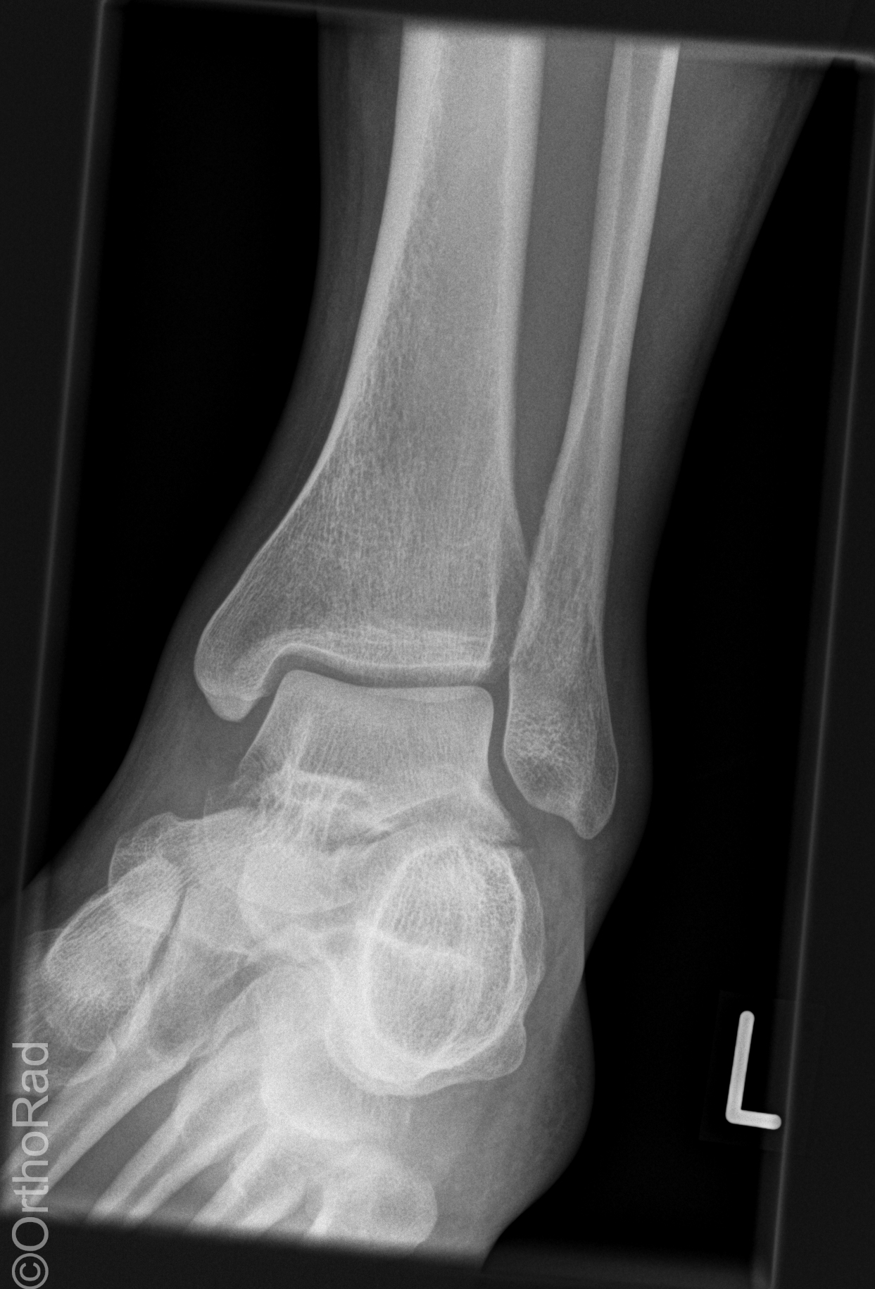 Wo ist der Medialis?