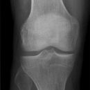 knie1.jpg