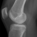 knie2.jpg